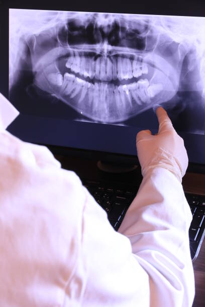 Best Emergency Tooth Extraction in Dumfries, VA