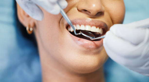 Best Walk-In Emergency Dentist in Dumfries, VA