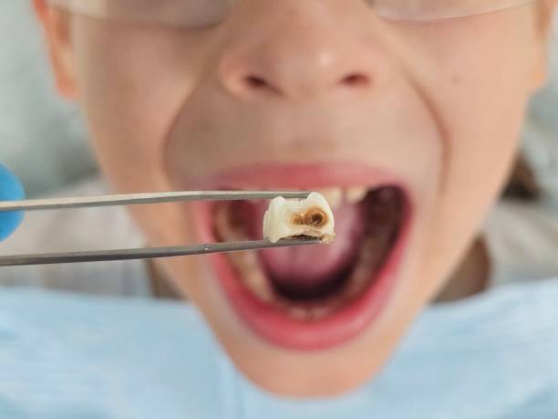 Best Same-Day Emergency Dentist in Dumfries, VA