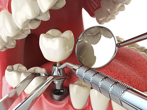 Best Emergency Dental Surgery in Dumfries, VA